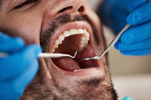 Best Cosmetic Emergency Dentistry in Urbana, IA